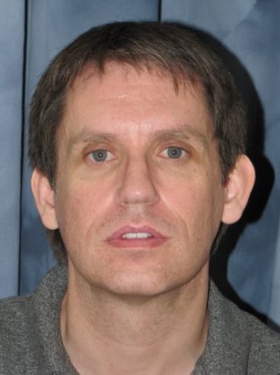 Male Patient 3 – Facelift