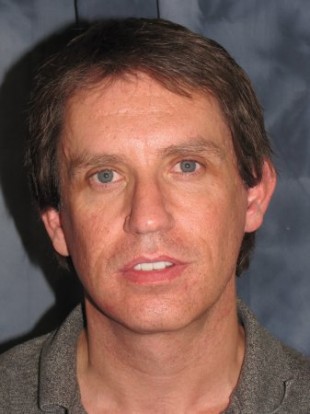 Male Patient 3 – Facelift