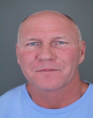 Male Patient Eyelid Lift- 2