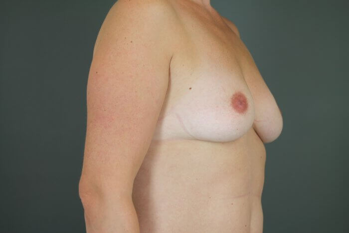 Begley, Ediola (20160404134403633) 20160603161806287