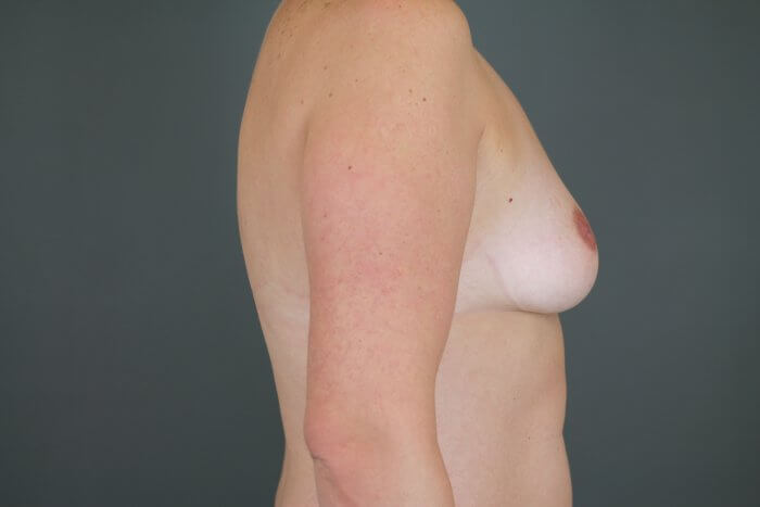 Begley, Ediola (20160404134403633) 20160603161807800