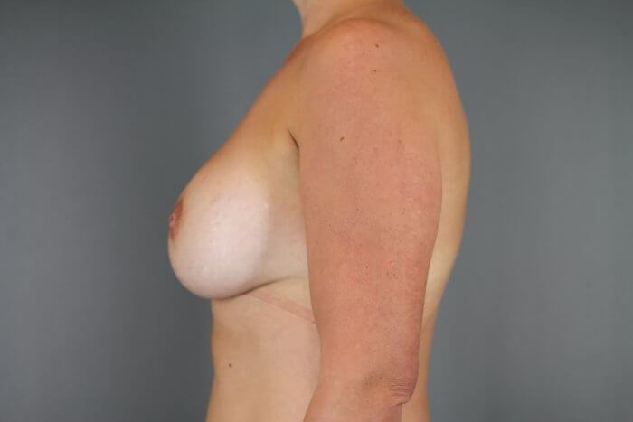 Begley, Ediola (20160404134403633) 20160919091635205