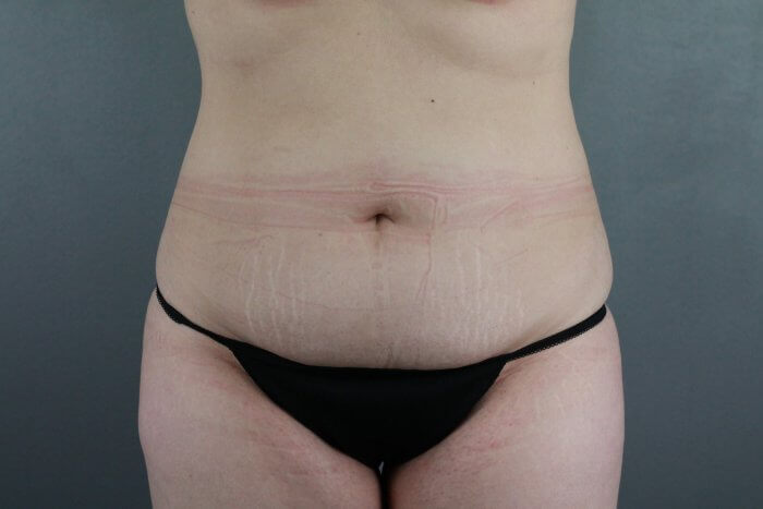 Kussman, Kelly (20171221165631519) 20200317135529428