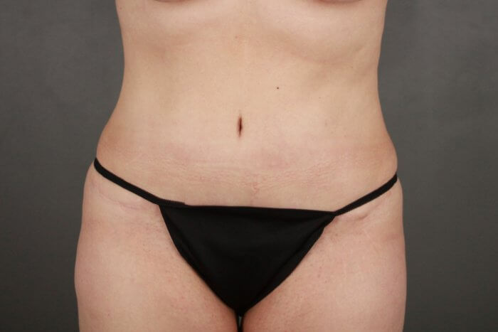 Kussman, Kelly (20171221165631519) 20200317135703965