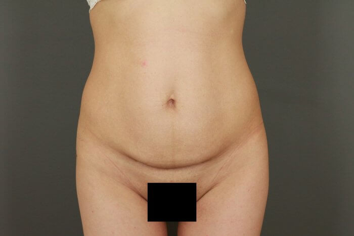 Liu, Lina (20150511132655189) 20200630113435498