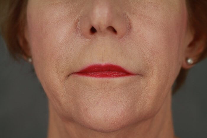 Burggraf, Holly (20190604120057970) 20191220160924327