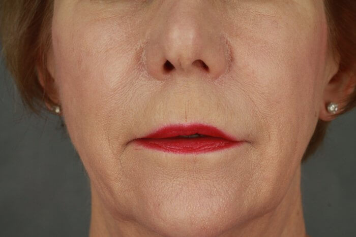 Burggraf, Holly (20190604120057970) 20191220160927120