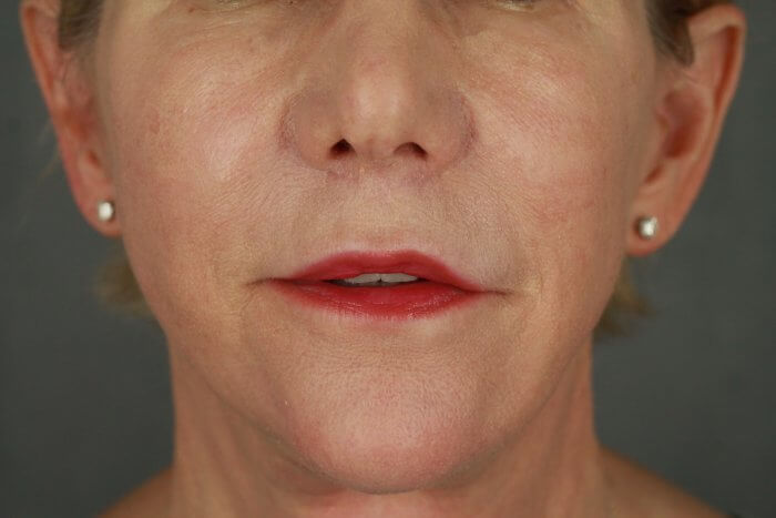 Burggraf, Holly (20190604120057970) 20200603091535614