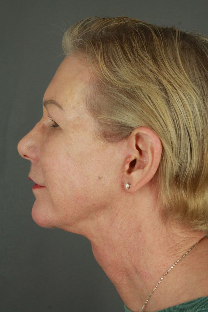 Burggraf, Holly (20190604120057970) 20200603091608908