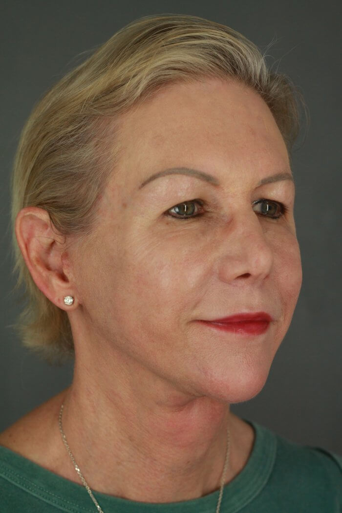 Burggraf, Holly (20190604120057970) 20200603091612275